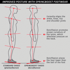 Mejora en la postura y en el equilibrio del eje central con calzado Springboost con dorsi technology