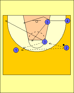 Sistema de ataque contra zona par o impar. Coleccionable ataque contra  zona. Entrega 2 | Baloncesto JGBasket 